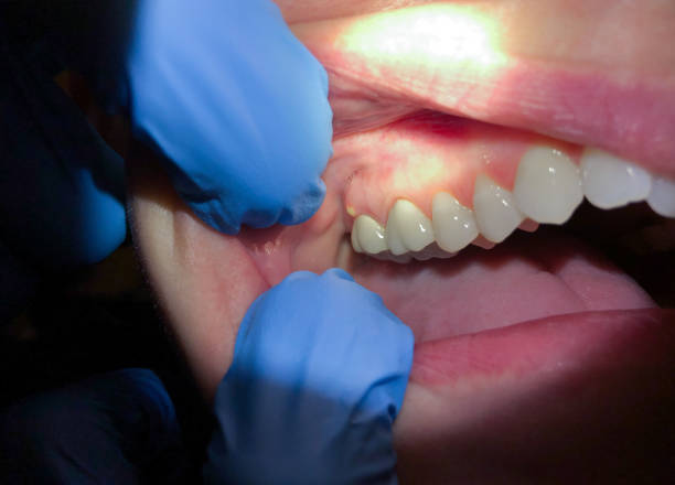 Best Tooth Infection Emergency Dentist  in Bellville, TX